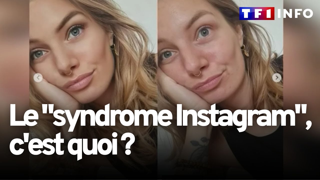 Troubles anxio-dépressifs, baisse de l’estime de soi… C’est quoi « le syndrome Instagram » ?